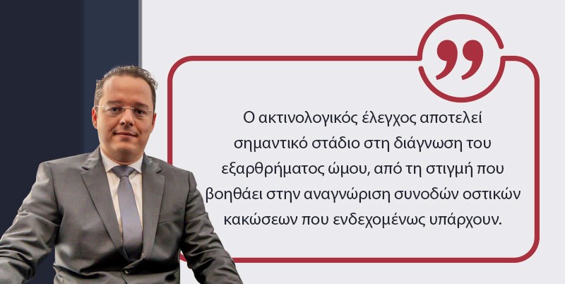 εξάρθρημα ώμου